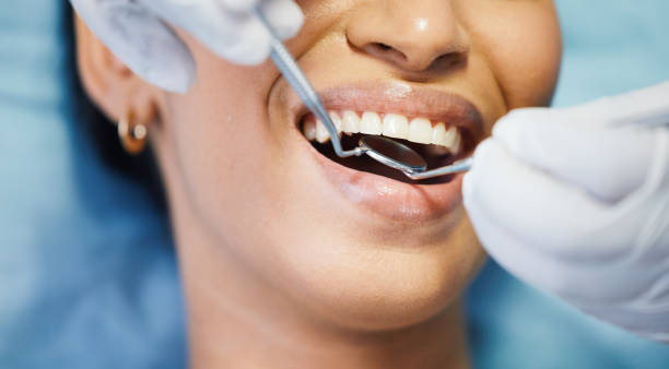 Best Emergency Tooth Extraction  in Novato, CA