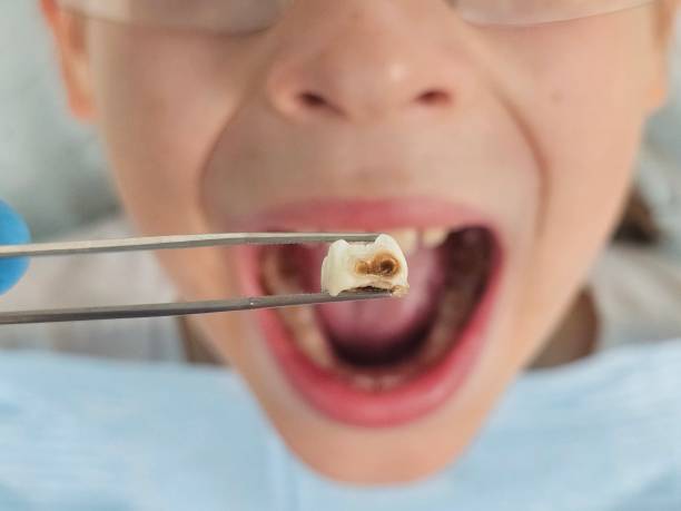 Best Root Canal Emergency Dentist  in Novato, CA